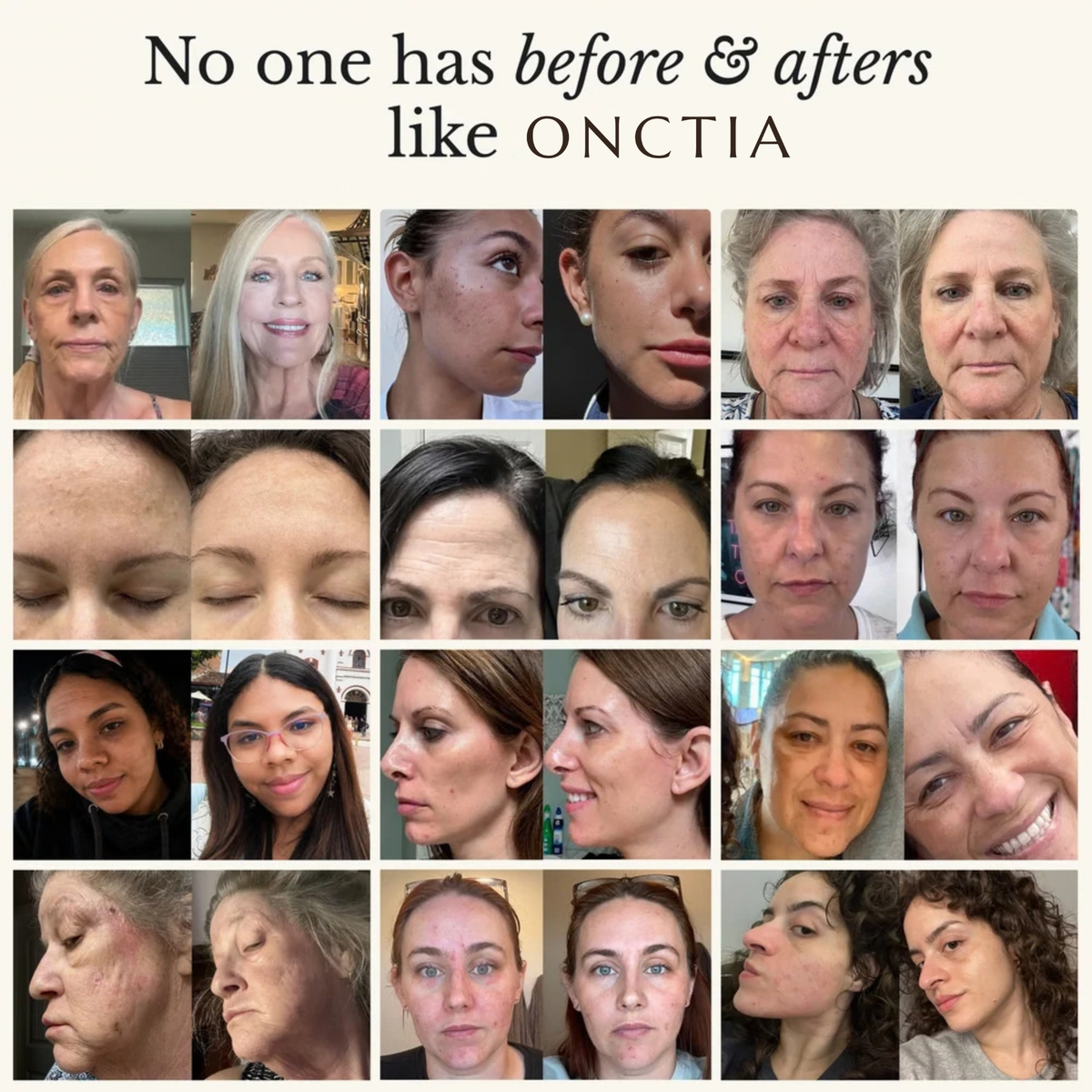 Le Rituel Onctia — Coffret 4 soins